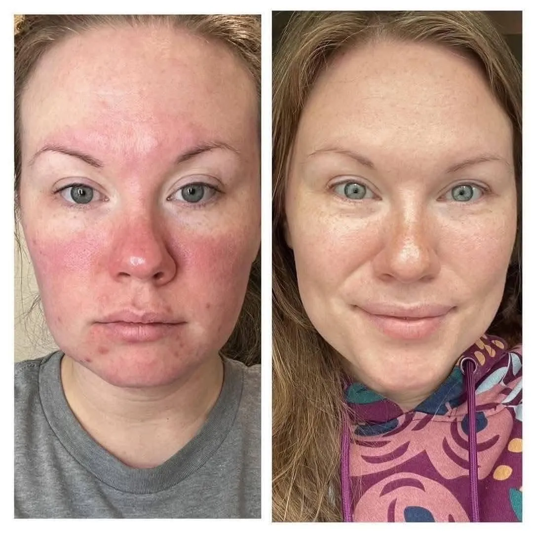 Mujer relajada recibiendo un tratamiento facial suave