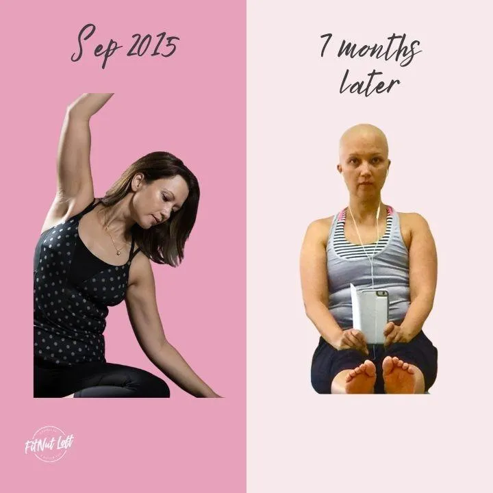 A before and after photo of Founder of FitNut Loft Singapore, Aly Khairuddin before and after breast cancer. In the after photo she is bald after chemotherapy.