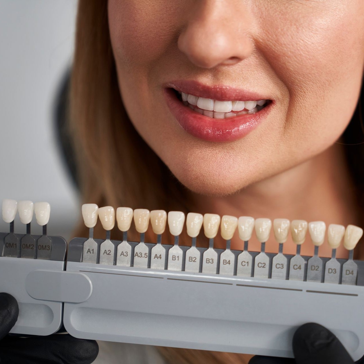 Crowns, Clermont Hills Dentistry, Clermont FL