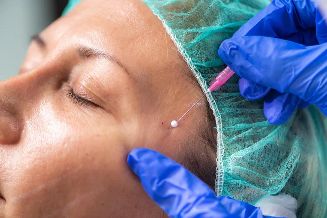 dermal-fillers-plymouth