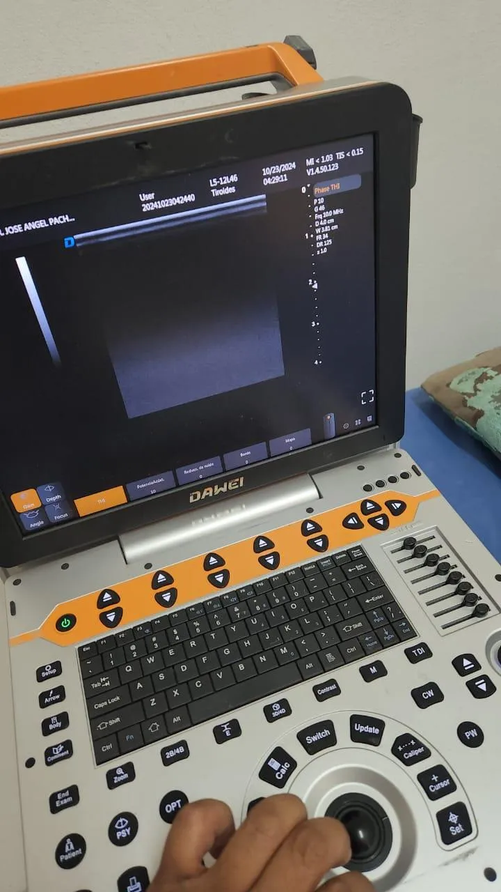 Equipo de ultrasonido de alta tecnología