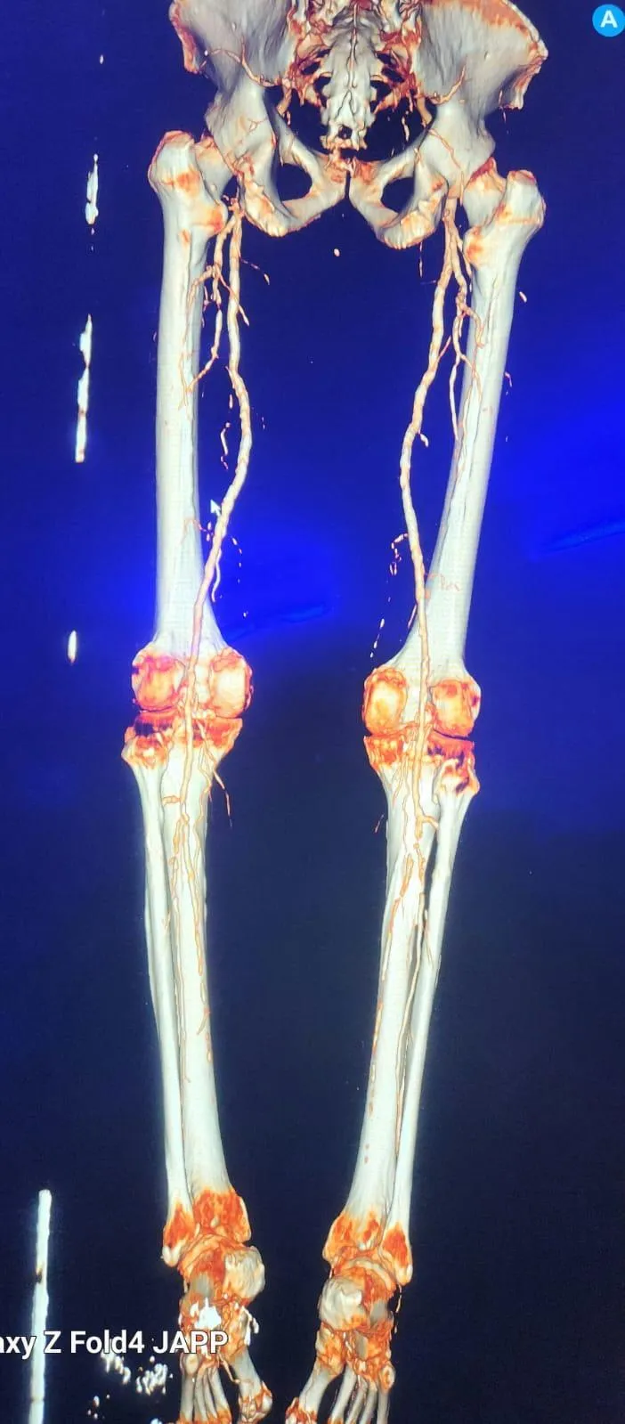 Equipo de ultrasonido