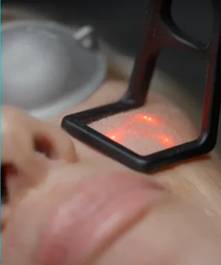 A Caucasian woman receiving a microdermabrasion facial treatment at Body in Balance, enhancing skin texture and glow with exfoliation.