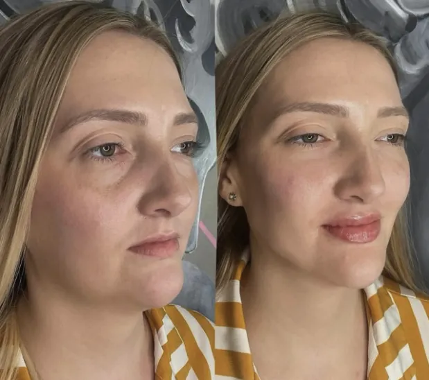 The Future of Beauty: 2030 Aesthetic Trends and Innovations in Delray Beach