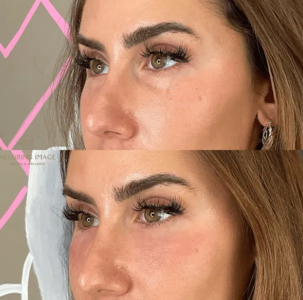 The 20-Something's Guide to Starting Botox at a Delray Beach Med Spa