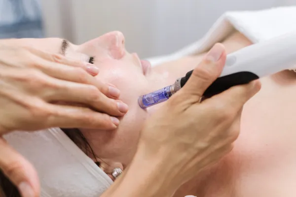 HydraFacial Vs. Microneedling: Which Is Better For Your Skin Goals?