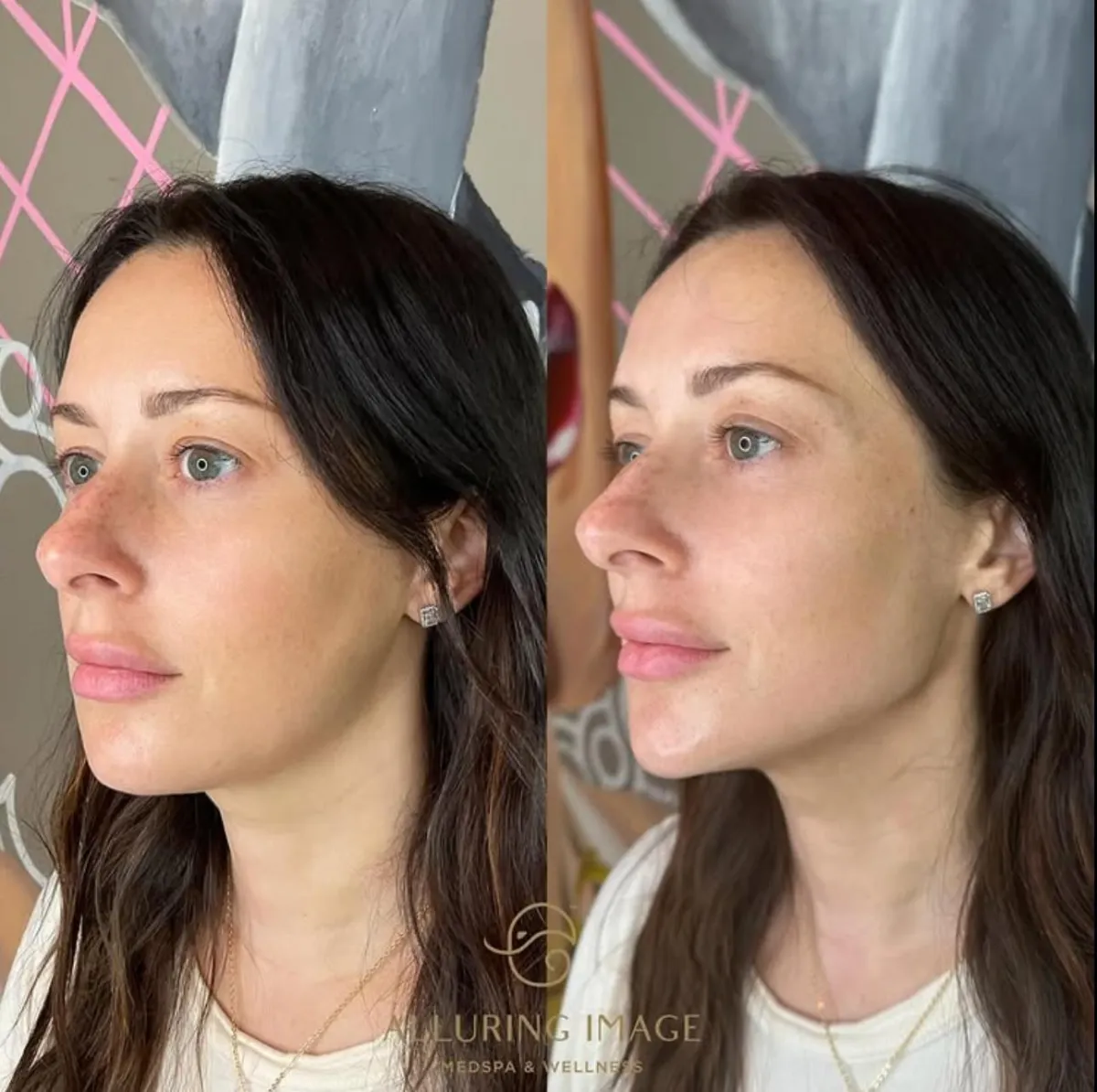 A luxury medical spa consultation setting featuring high-end skincare products and a clean, clinical aesthetic.