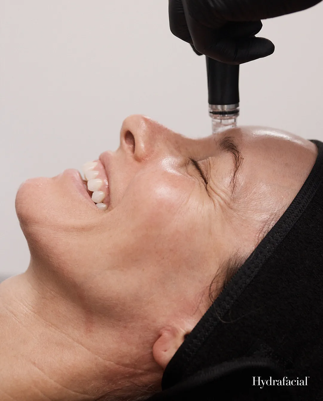 Hydrafacial treatment in progress
