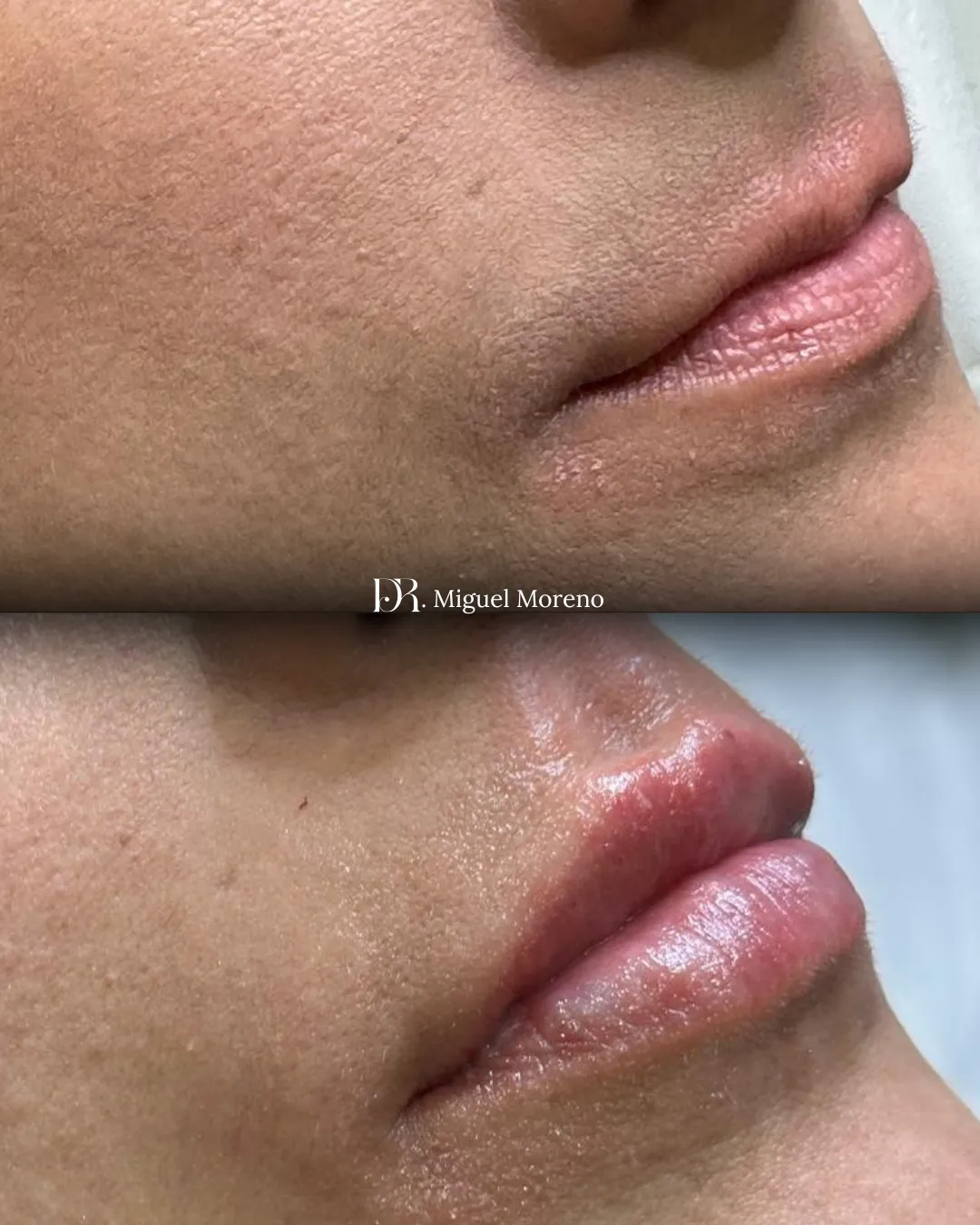 A bottle of lotion sitting next to some fruit