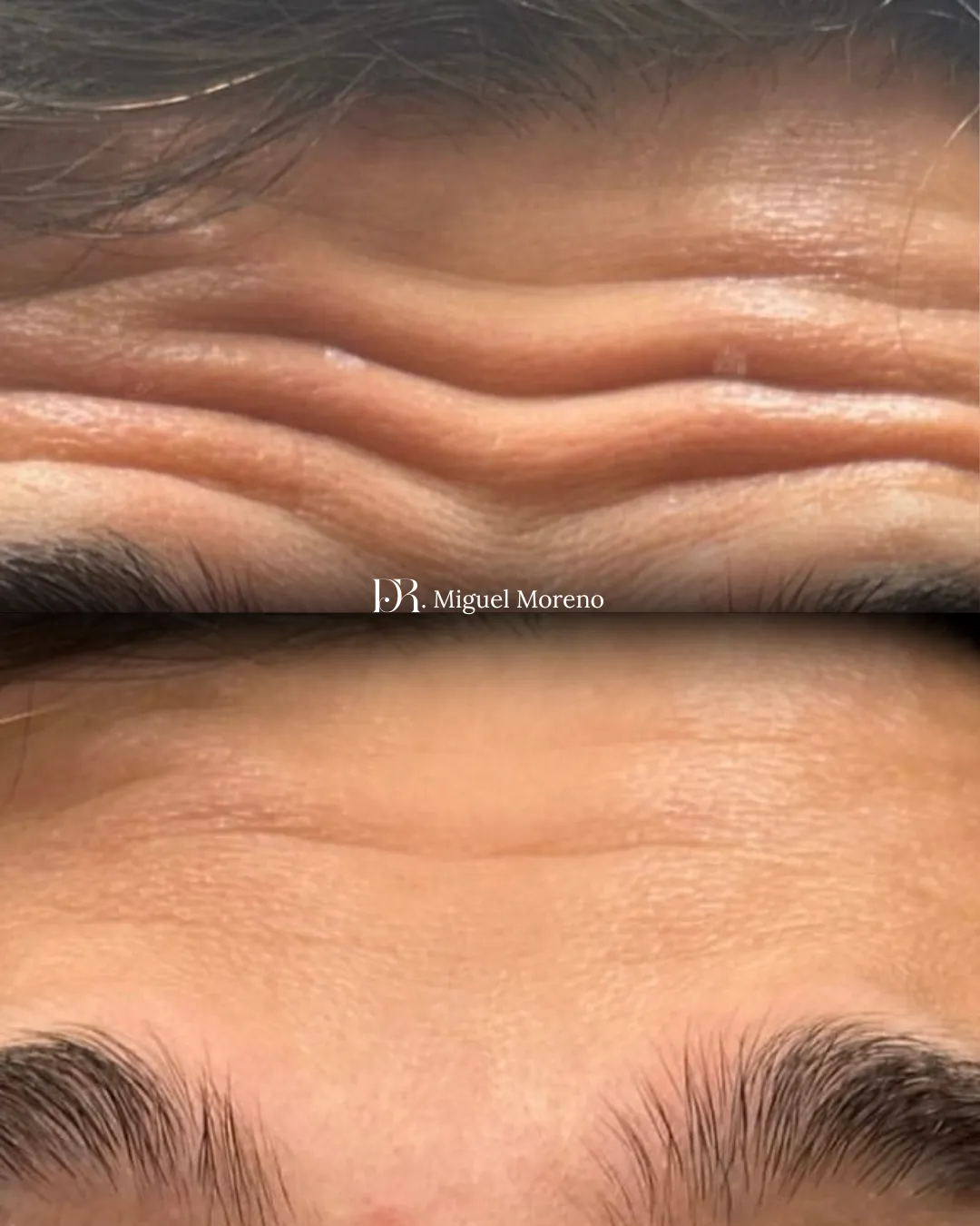 gray rocks on seashore during daytime