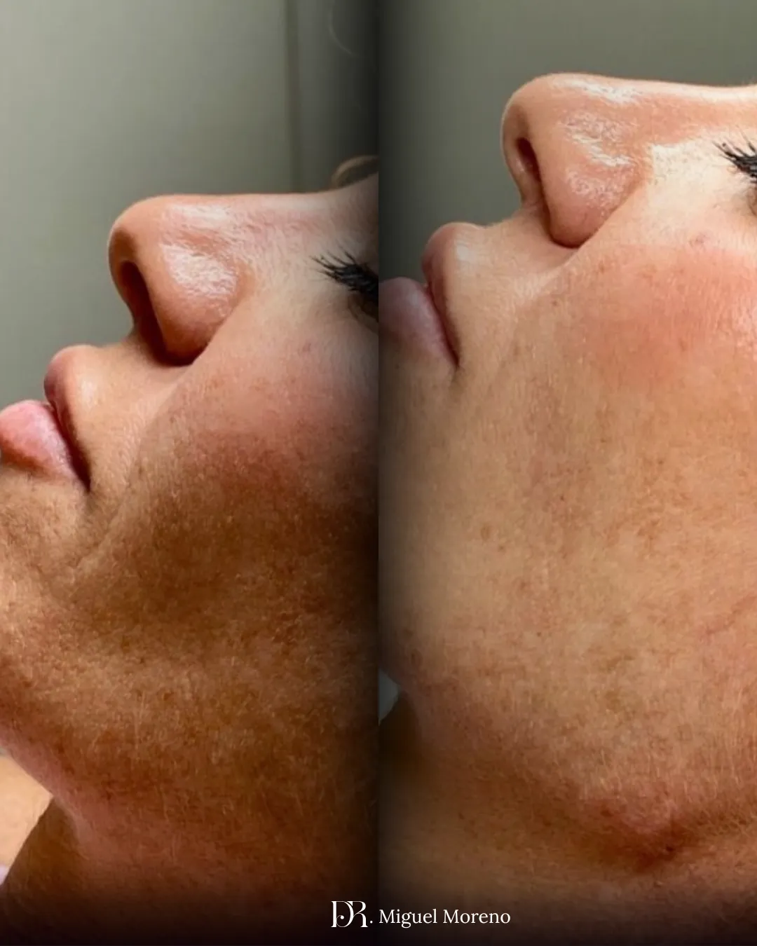 brown wooden dock near lake surrounded with tall trees