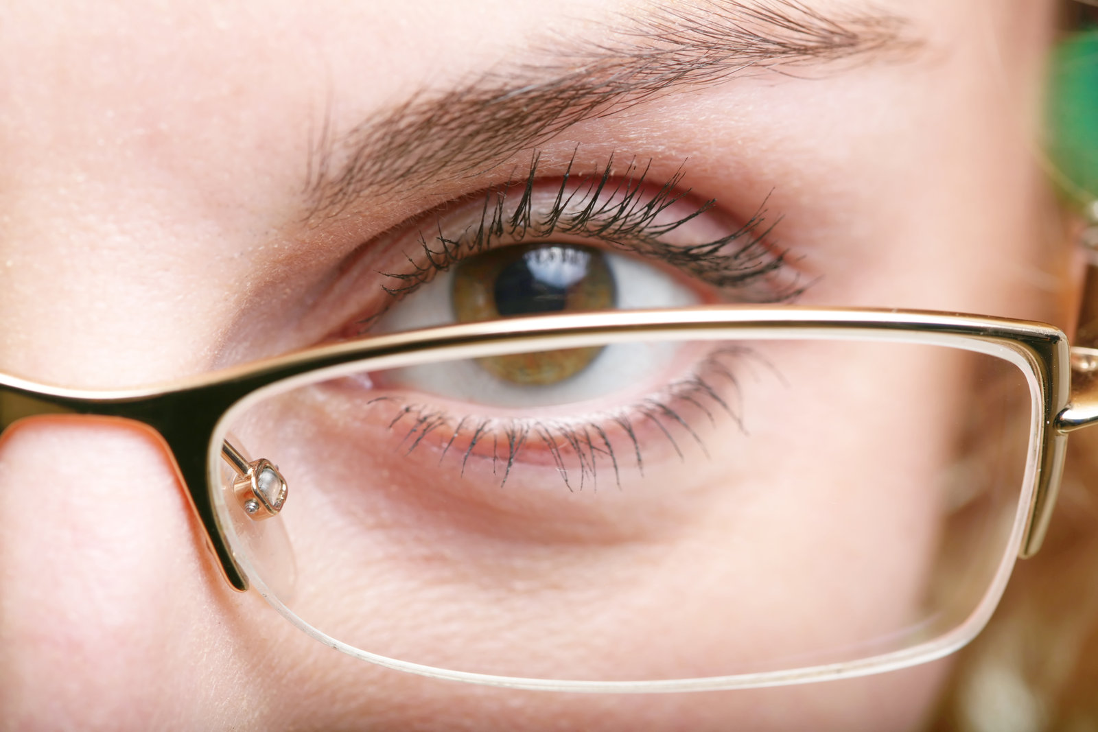 What Is Keratoconus? Symptoms, Causes, & Treatment