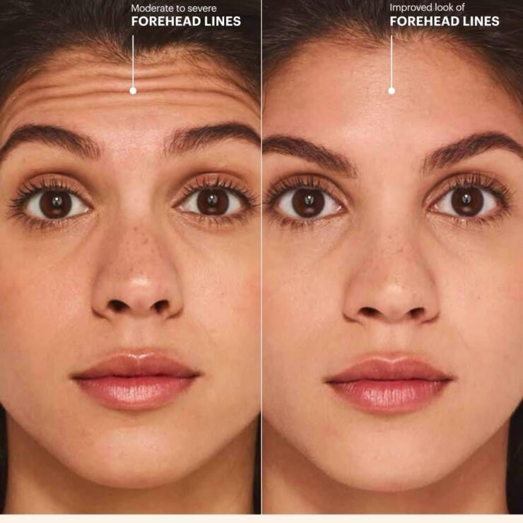 Before and after result 1