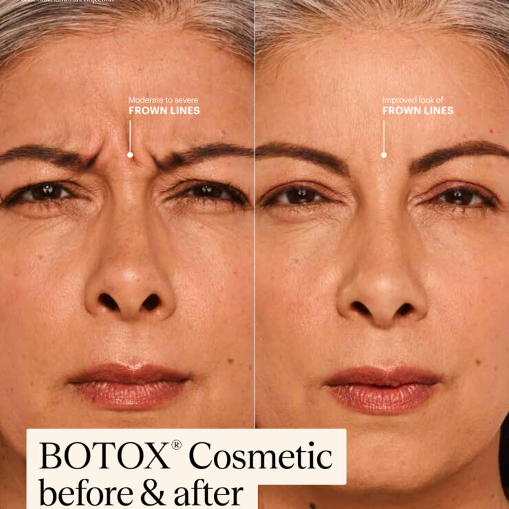 Before and after result 2