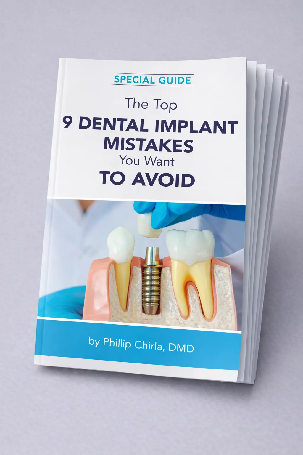 Dental Arts of Wadsworth Implant Guide