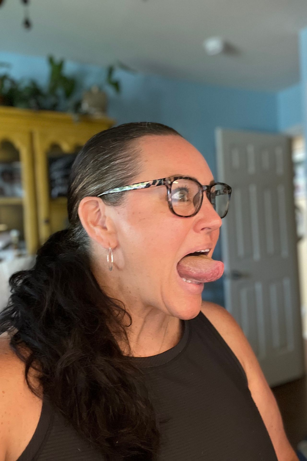 Carmen Ball demonstrating tongue posture during a myofunctional therapy evaluation