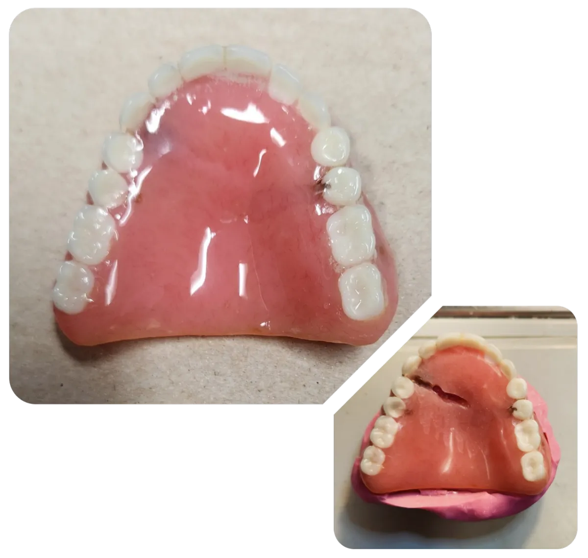 Polaris Dental Lab Denture Repair