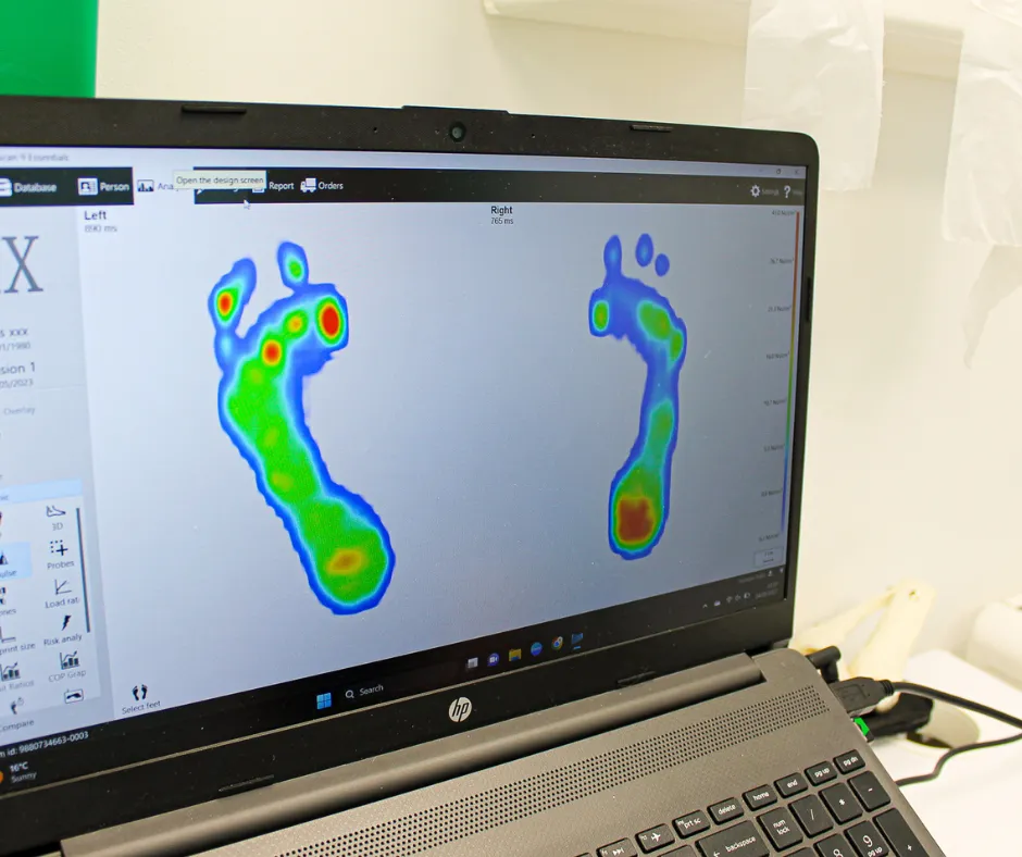 How Gait Analysis Prevents Running Injuries and Improves Performance