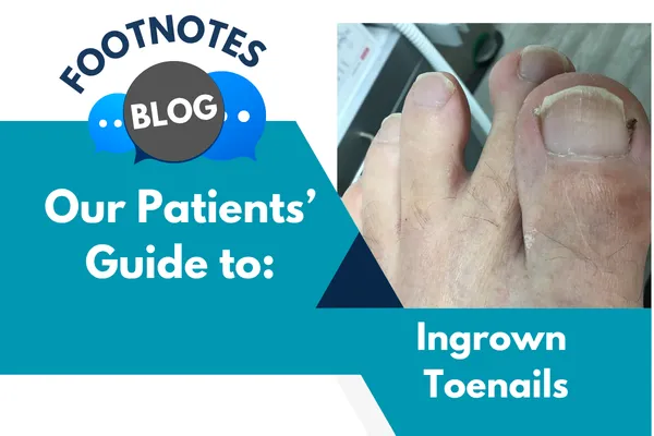 The Agony of an Ingrown Toenail