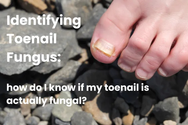 Identifying Toenail Fungus: Signs and Solutions