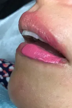 3D Areola Tattoo In Houston