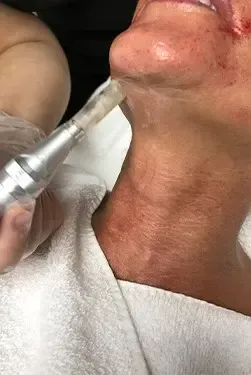 3D Areola Tattoo In Houston