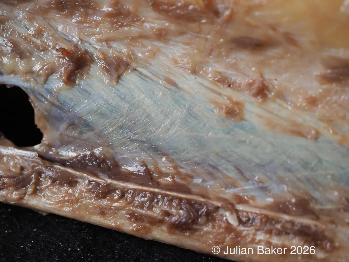 Dissection of Interosseus membrane showing blending of membrane into periosteum and crural fascia