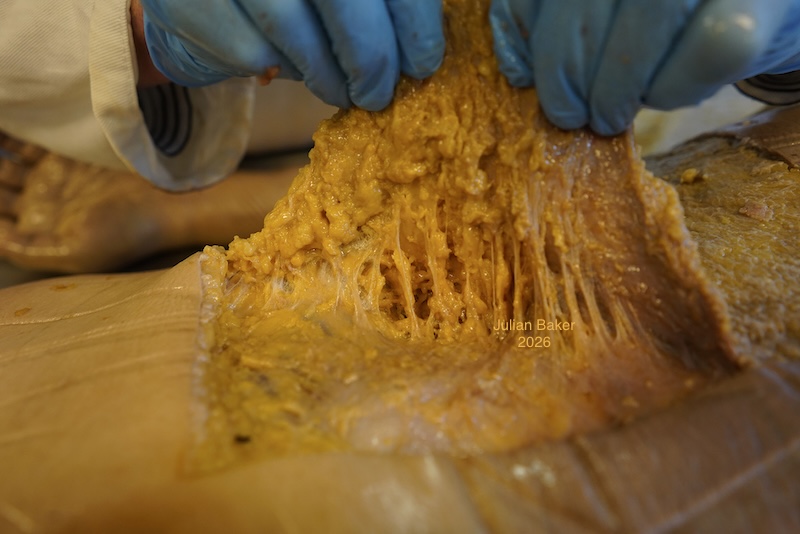 superficial fascia collagen fibres in dissection