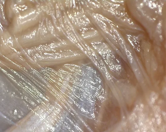 What Is Fascia? The Tissue, the Hype and the Evidence