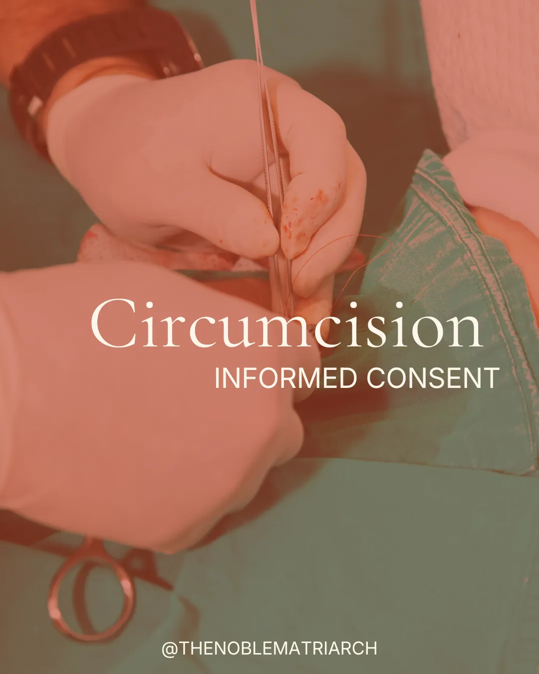 
Informed Consent: Circumcision
