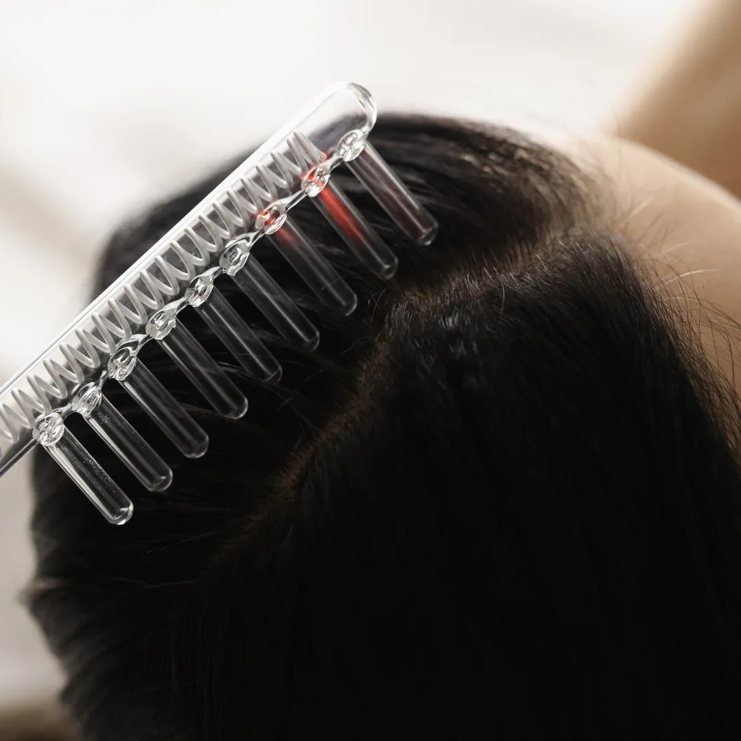 Close-up of a person’s scalp undergoing a high-frequency hair treatment using a glass comb electrode. The transparent comb emits a faint orange-red glow, indicating the use of electrical stimulation for scalp therapy or hair growth.