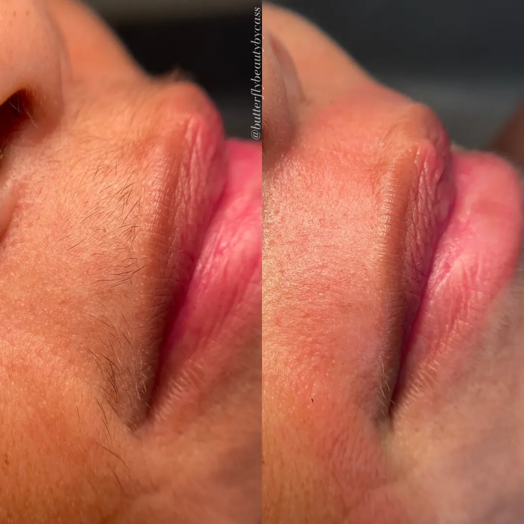 Lip Waxing