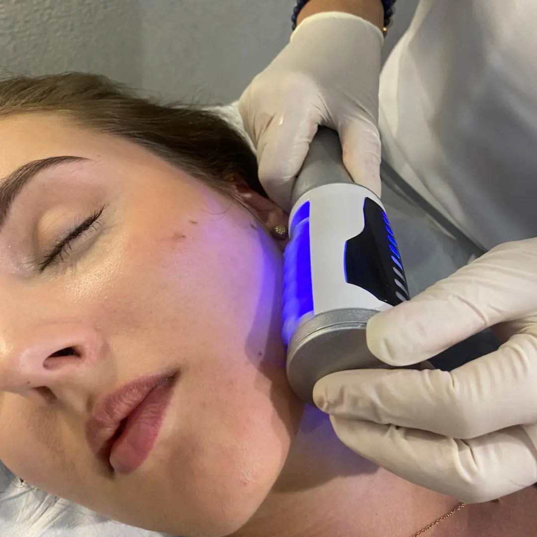 Endospheres facial therapy session demonstrating non-invasive skin tightening and rejuvenation treatment
