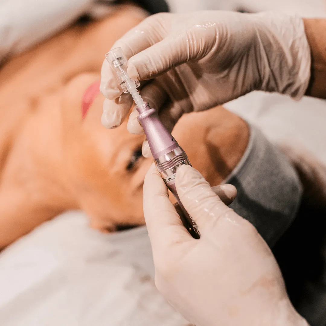 Microneedling facial in Knightsbridge London