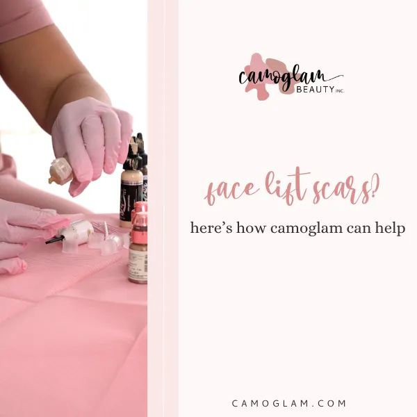 face lift scars? here’s how camoglam can help