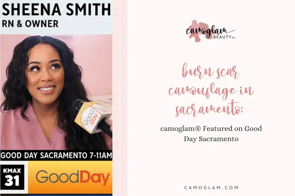 Burn Scar Camouflage in Sacramento: camoglam® Featured on Good Day Sacramento
