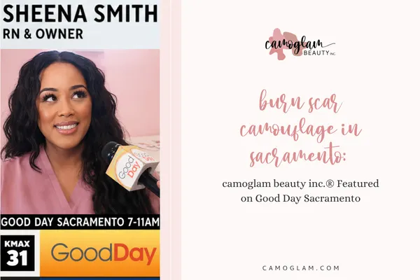 Burn Scar Camouflage in Sacramento: camoglam® Featured on Good Day Sacramento