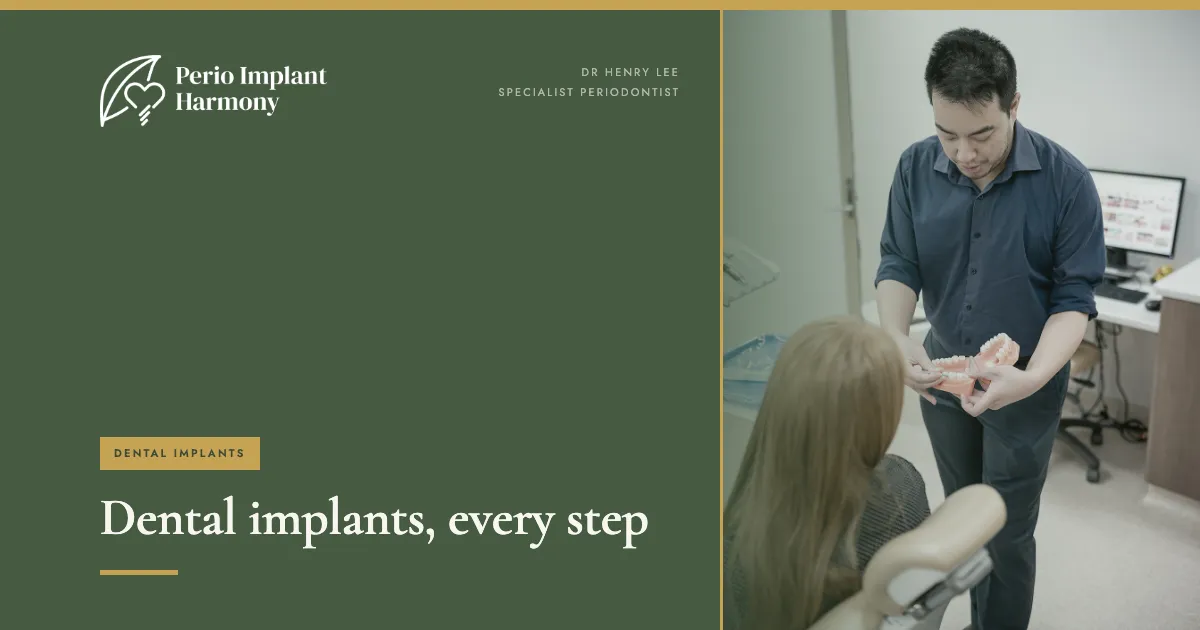 Dental Implants Explained: What to Expect at Every Step