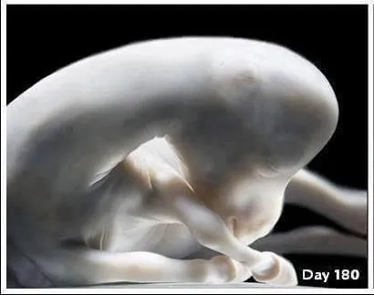 Equine fetus at 180 days gestation—developing foal showing defined limbs and facial structure in utero.