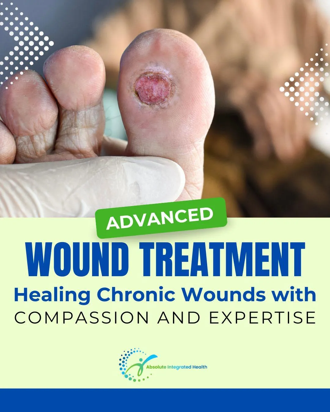 Advanced Wound Care in Plainfield, IL: Healing Stubborn Wounds with Specialized Treatment