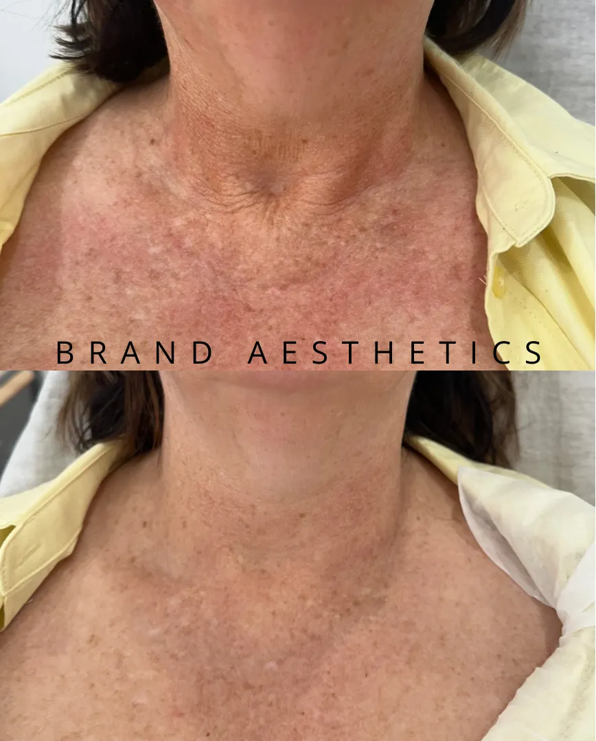 Kimberley Brand Consultation & Assessment
