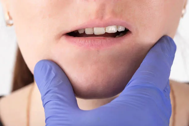 Oral Cancer