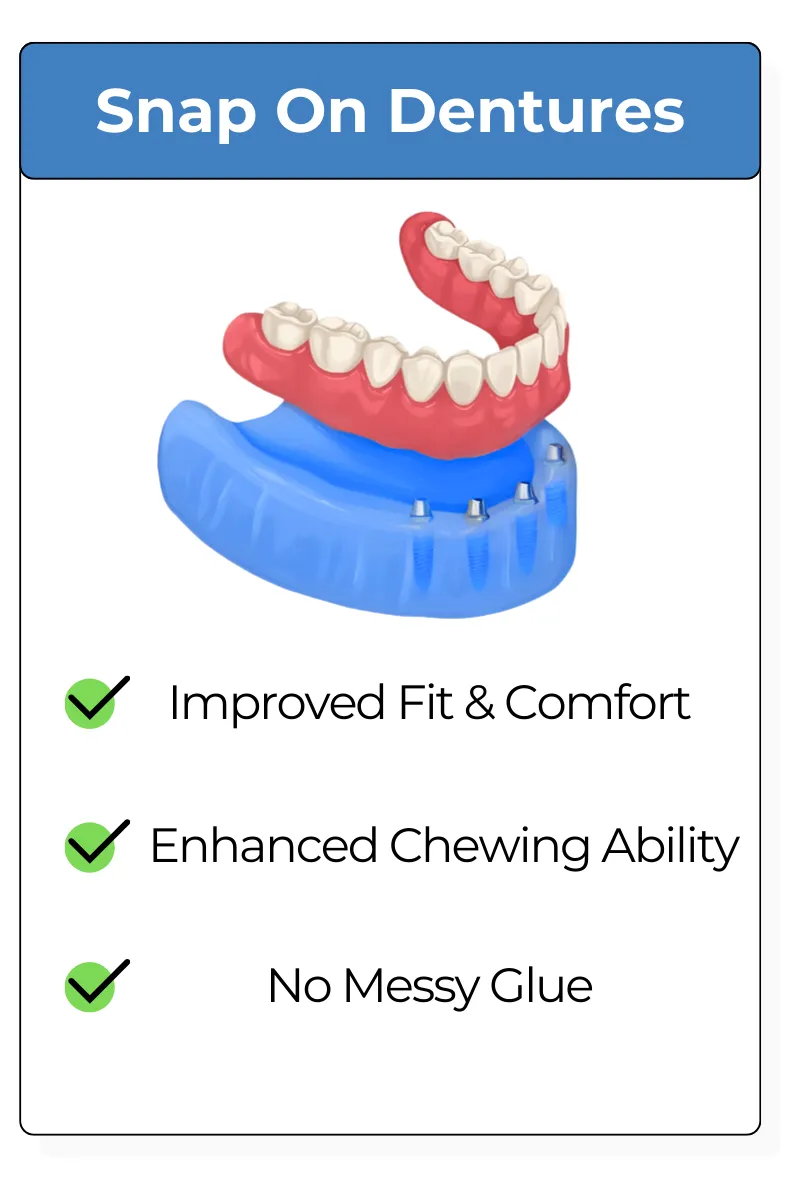 Snap On Dentures