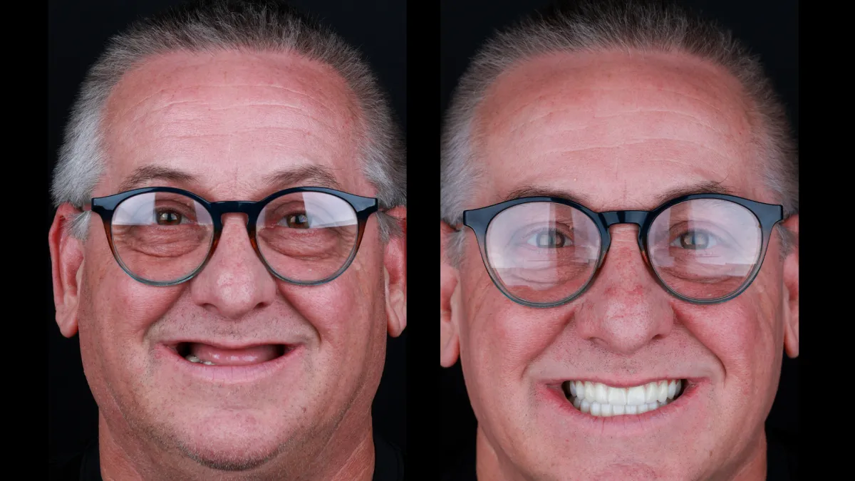 Couple Smiling with Perfect Teeth