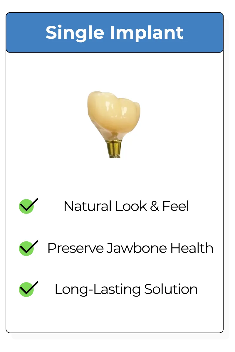 Single Dental Implant
