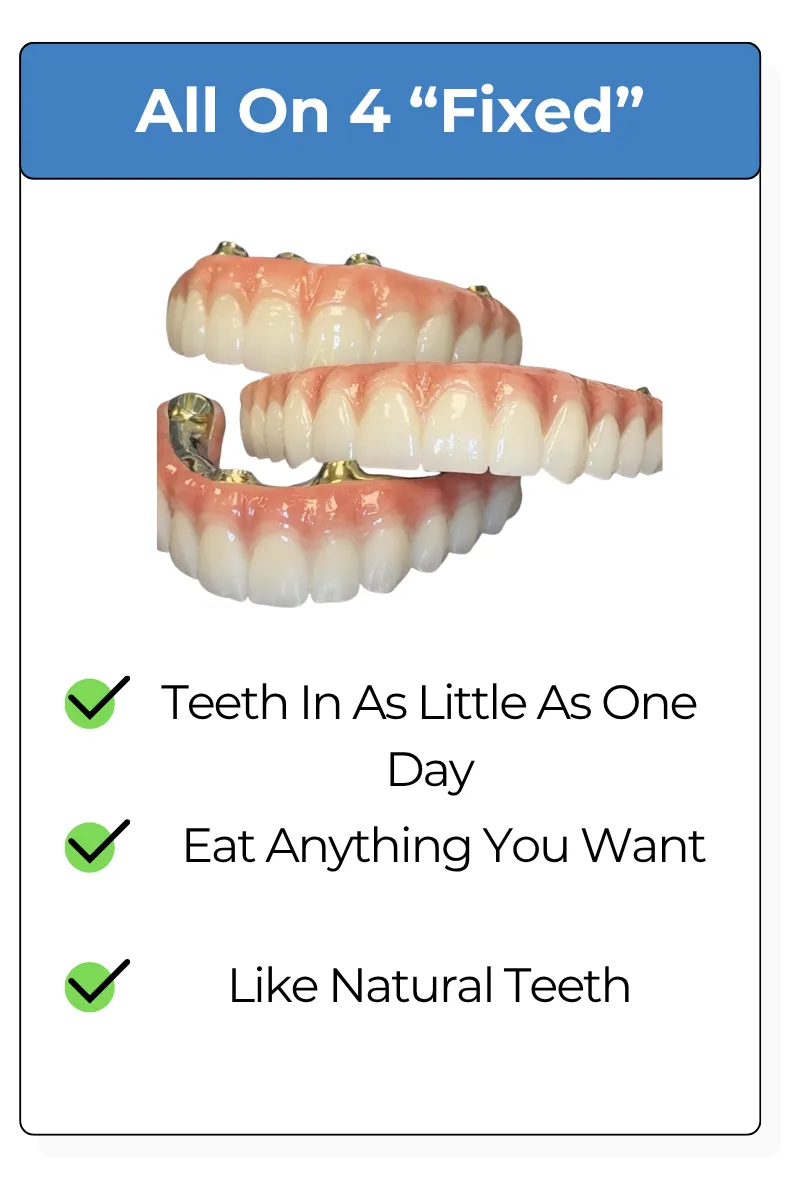 All on Four Dental Implants