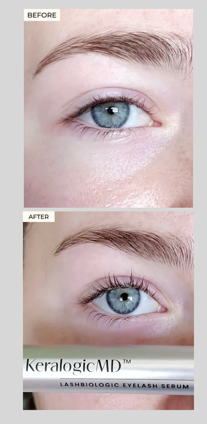eye summit partner- lash serum