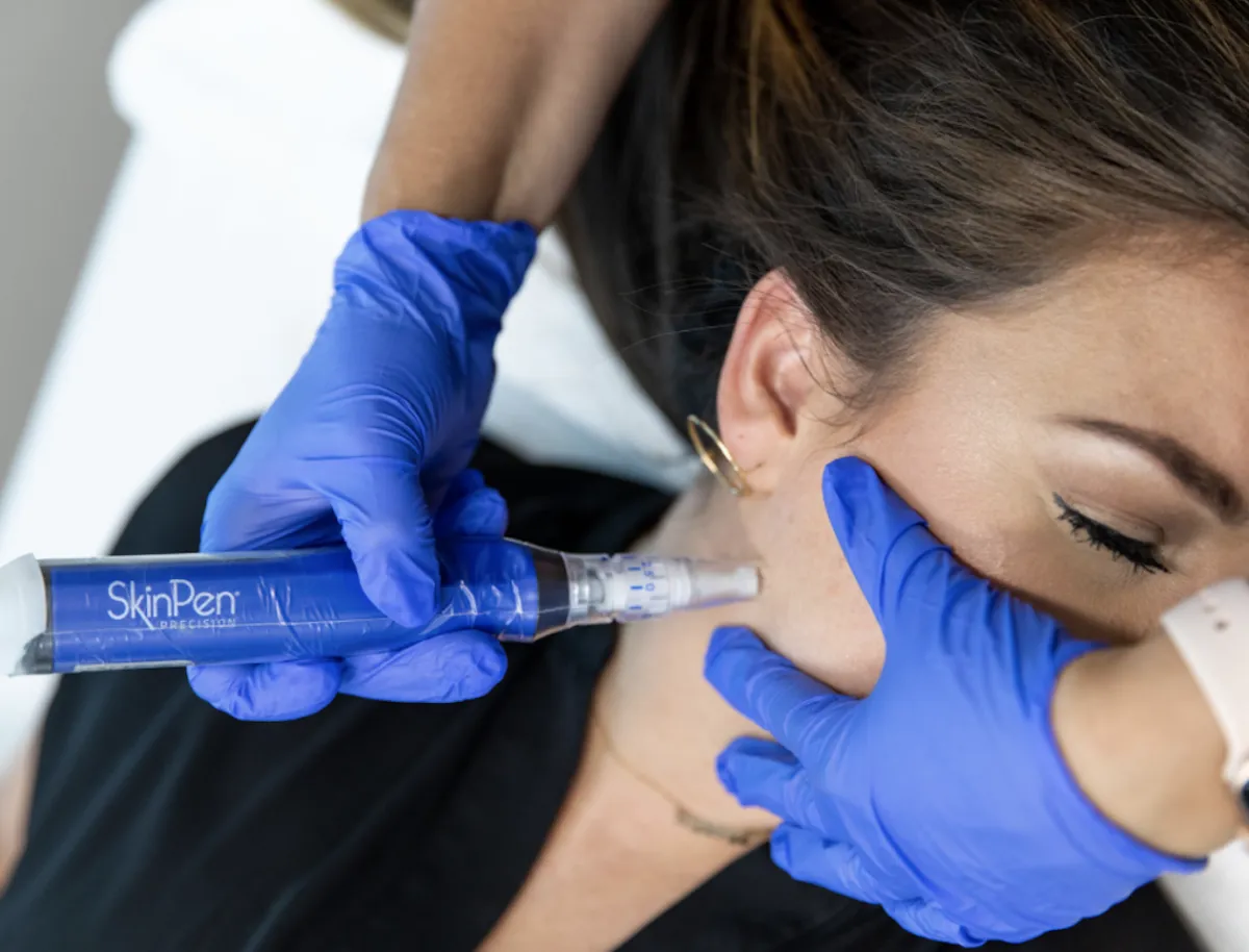A licensed provider performing a SkinPen microneedling treatment on a client's cheek at The Aesthetics Lounge Pinecrest.