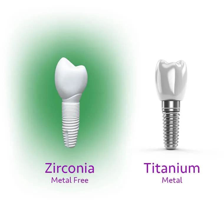 metal dental implant vs non metal dental implant
