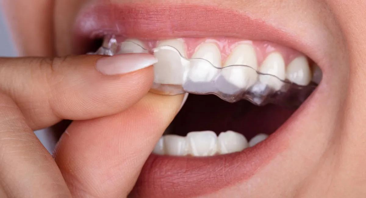 Woman holding invisalign